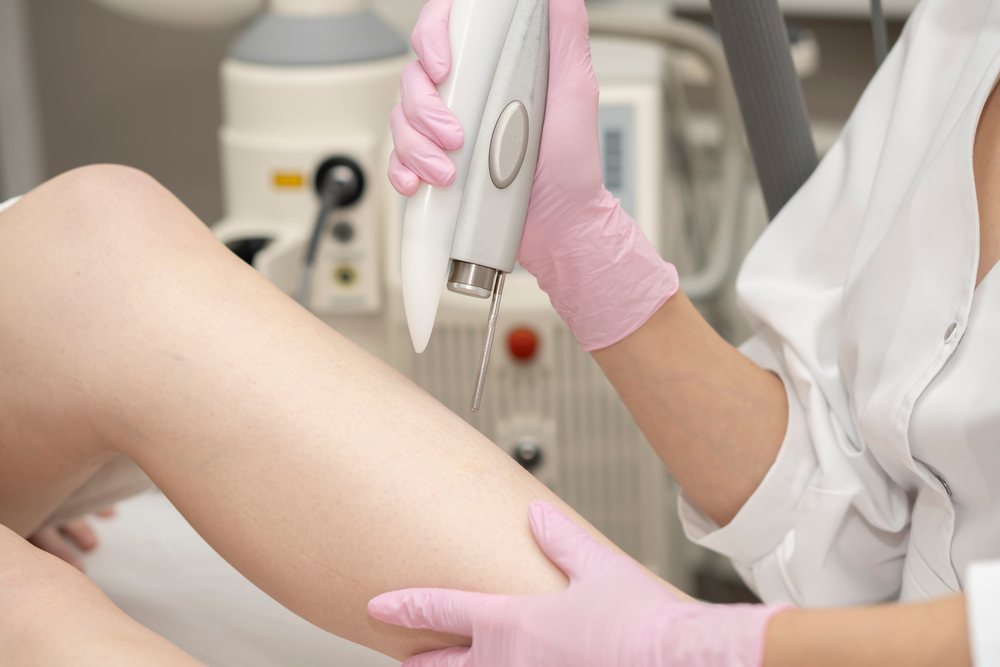 Laser Hair Removal In Balham: Say Goodbye to Unwanted Hair Today!