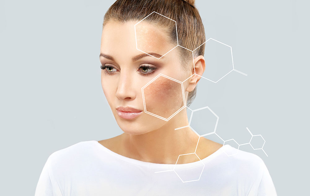 How to Prevent Skin Pigmentation: 6 Proactive Steps for Healthy, Even Skin